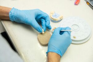 Brücke als Zwischenlösung vor Implantat: Wann das infrage kommt