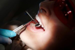 Implantat für Schneidezahn: Kosten, Optik und Heilungszeit