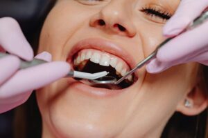 Implantat und Zahnfleischaufbau: Kosten und Ablauf