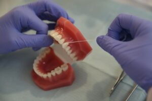 Warum Brücken bei schlechter Mundhygiene schneller Probleme machen
